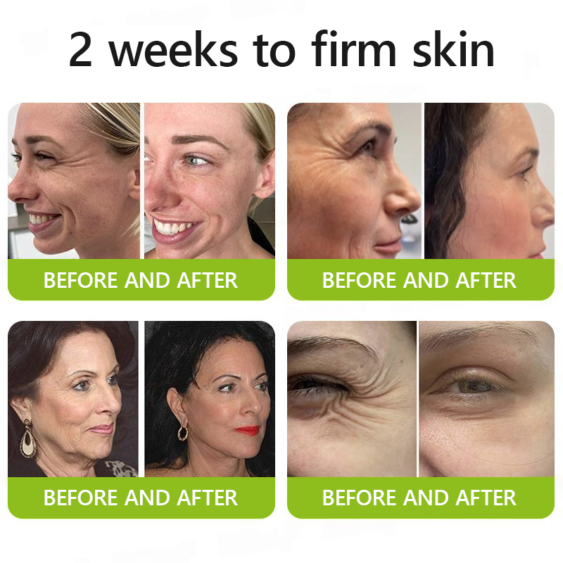 Regain youthful skin nown 💫LOVILDS® BOTOX & VITA A RETINOL SHOT Wrinkle Lift Tightening Cream