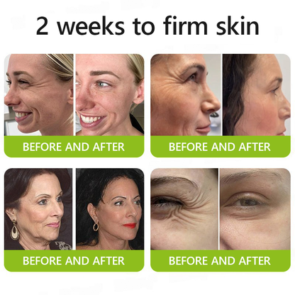 Regain youthful skin nown 💫LOVILDS® BOTOX & VITA A RETINOL SHOT Wrinkle Lift Tightening Cream
