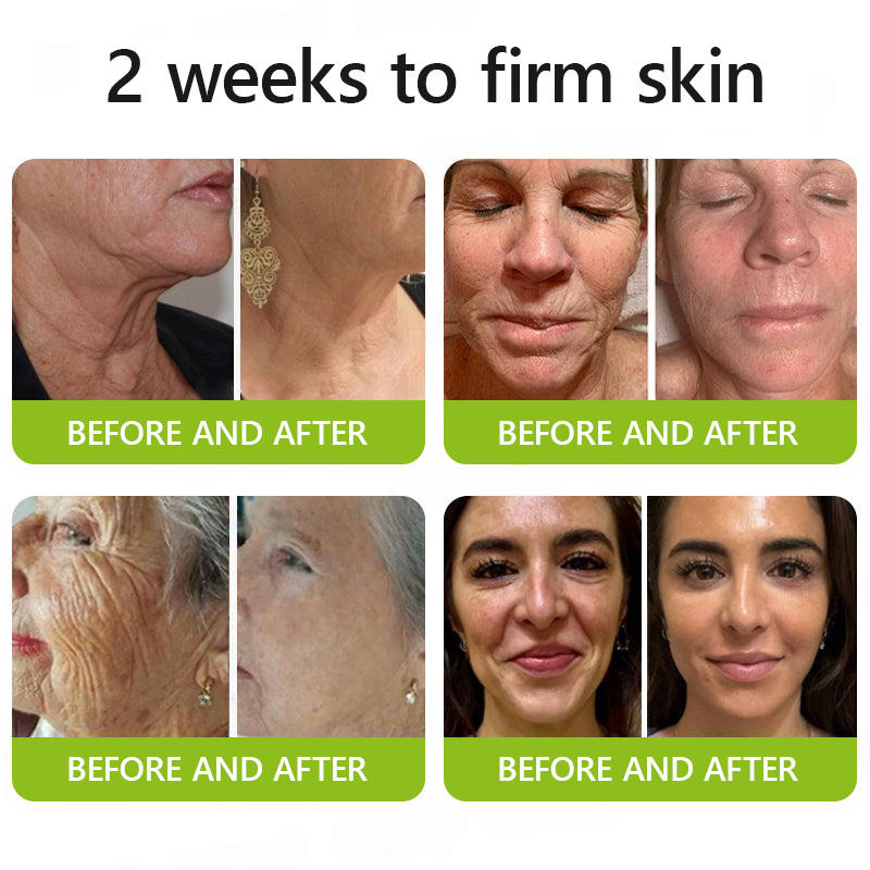 Regain youthful skin nown 💫LOVILDS® BOTOX & VITA A RETINOL SHOT Wrinkle Lift Tightening Cream