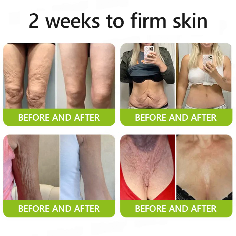 Regain youthful skin nown 💫LOVILDS® BOTOX & VITA A RETINOL SHOT Wrinkle Lift Tightening Cream