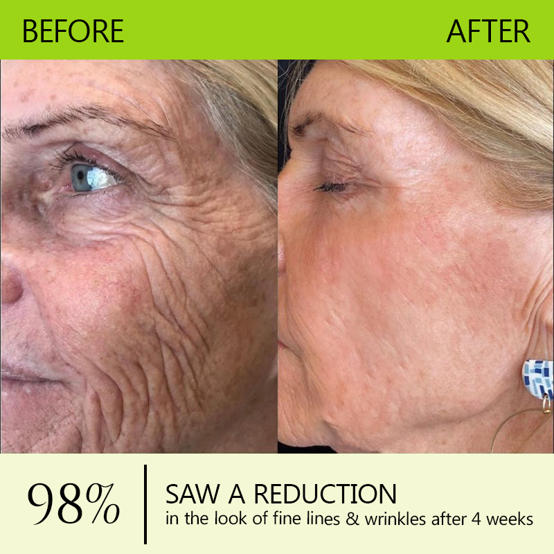 Regain youthful skin nown 💫LOVILDS® BOTOX & VITA A RETINOL SHOT Wrinkle Lift Tightening Cream