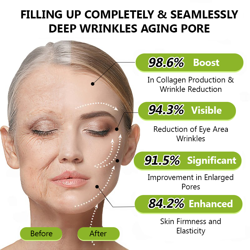 Regain youthful skin nown 💫LOVILDS® BOTOX & VITA A RETINOL SHOT Wrinkle Lift Tightening Cream