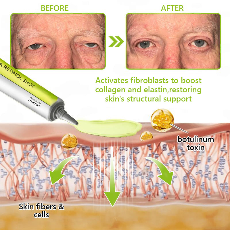Regain youthful skin nown 💫LOVILDS® BOTOX & VITA A RETINOL SHOT Wrinkle Lift Tightening Cream