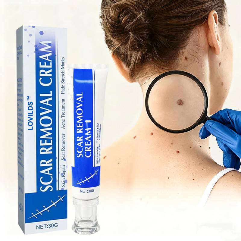 Professional Wart & Scar Removal Cream – Safe, Gentle & Effective Skin Care