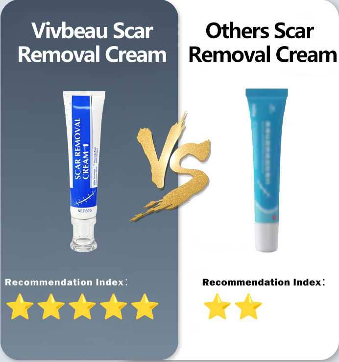Professional Wart & Scar Removal Cream – Safe, Gentle & Effective Skin Care