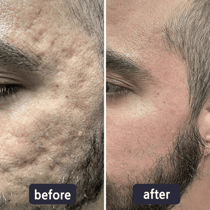 Professional Wart & Scar Removal Cream – Safe, Gentle & Effective Skin Care